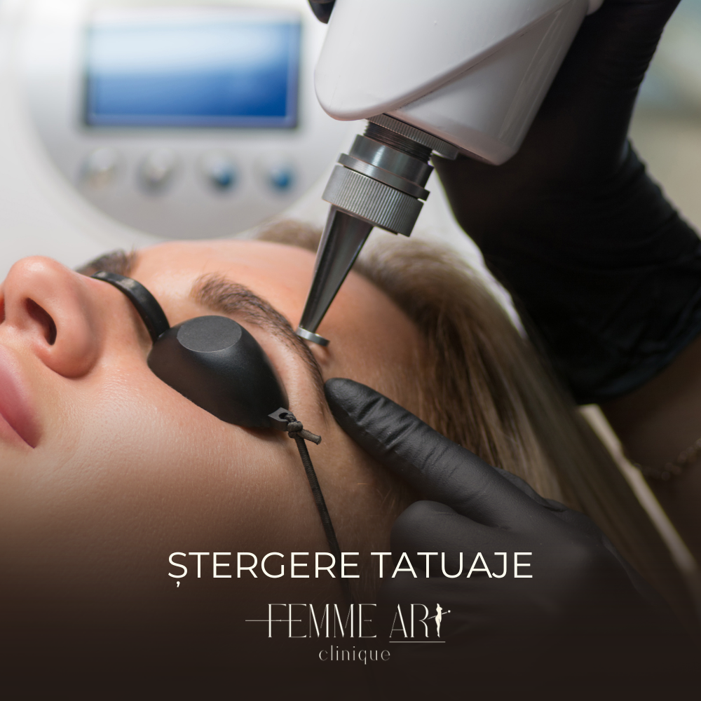 Ștergere tatuaj Brașov