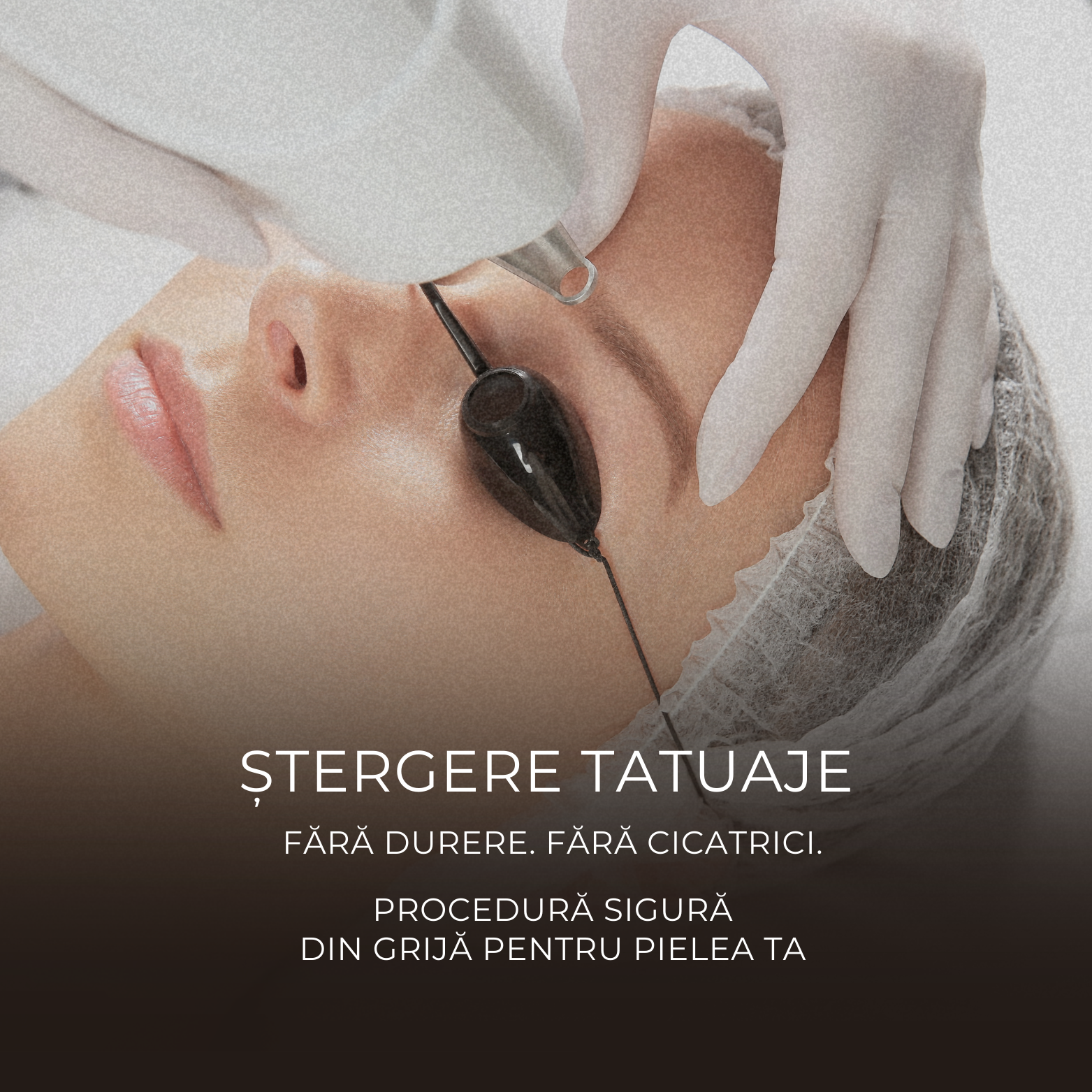 Ștergere tatuaj Brașov